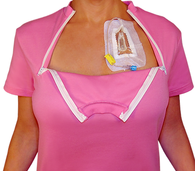 Porta-Caths: A Comprehensive Guide to This Essential Medical Device